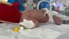 “Similar Digits” Sacrifices Fetus, Mother