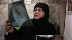 العراق: علاج مرضى السل المقاوم للأدوية المتعددة مريضًا تلو الآخر