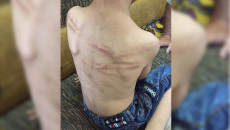 تم أعتقال والده<br>طفل يتعرض للتعذيب في كركوك